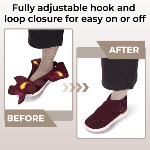 FitVille Diabetic Boots for Women Wide Width Fully Adjustable Straps Winter Boots for Women Wide Width with Warm Fur Lining womens wide snow boots for swollen feet Foot Pain Relief Neuropathy2