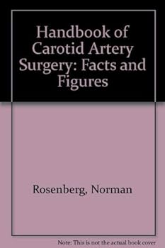 Hardcover Handbook of Carotid Artery Surgeryfacts and Figures Book