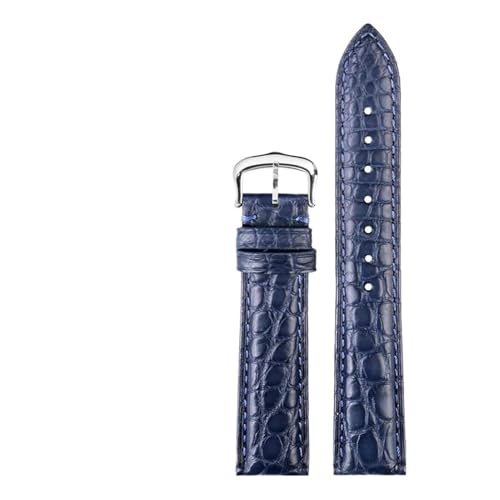 [-ł] 16/17/18/20mm NR_CEHb`ohuXbg JeBG h \V[Y Y fB[X U[EHb`XgbvΉ(Blue silver pin,17mm-width)