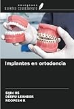 Implantes en ortodoncia (Spanish Edition)