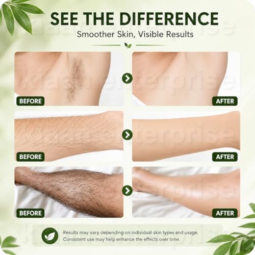 Image of Cyperus Rotundus Oil Hair Removal Spray for Women & Men | Cyprus Cypress Permanent Hair Reduction Oil for Face, Arms, Legs & Body (Pack of 2)