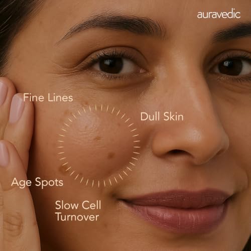 Image of Auravedic Kumkumadi Oil Retinol Night Cream For Face - Night Cream For Women With Niacinamide, Retinol, Saffron & Padmaka - Overnight Repair & Renew For Glowing Skin, 50g