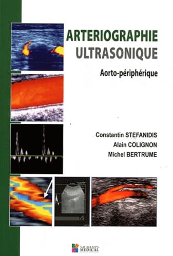ARTERIOGRAPHIE ULTRASONIQUE