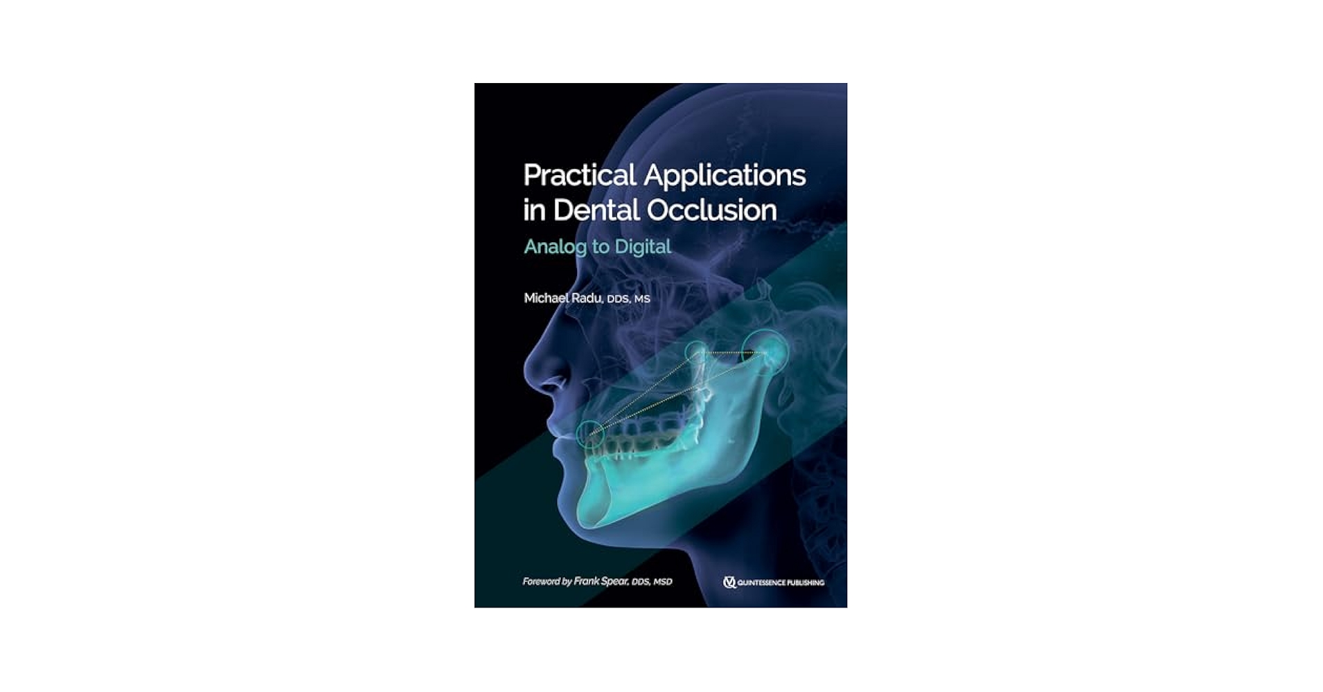 RESTORATIVE DESIGN & PRACTICAL OCCLUSIO… By Peter E. Dawson - Functional Occlusion: From TMJ to Smile
