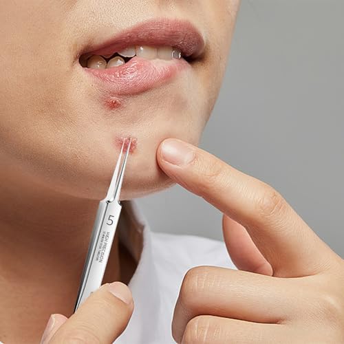 Splitterpinzette,Chirurgische Pinzette,Feine Pinzette,Pickel Pinzette,Mitesserpinzette Präzisions,Nadel Pickel Aufstechen,Splitterpinzette zum Entfernen von Blackheads Extraktor-Gerade Spitzen
