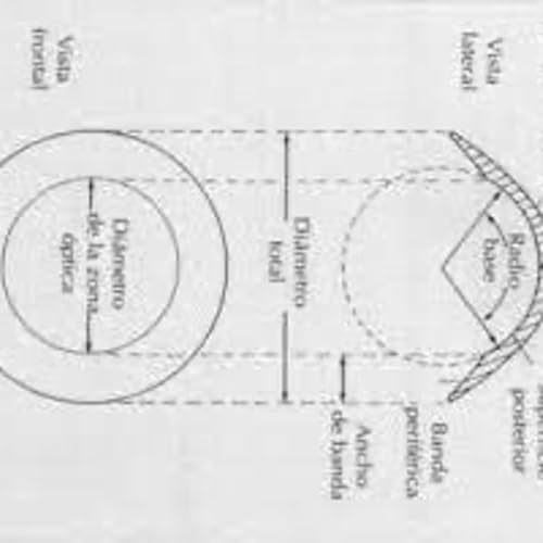 Partes de los lentes de contacto Parte 2 LEONEL SALMER&Oacute;N LEAL