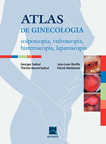 Atlas de Ginecologia