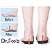 Dr. Foot's 3/4 Length Orthotics Insoles - Best Insoles for Corrects Over-Pronation, Fallen Arches, Fat Feet - Plantar Fasciitis, Heel Spurs and Other Foot Conditions -1 pair (M- W9-10.5 | M7.5-9)