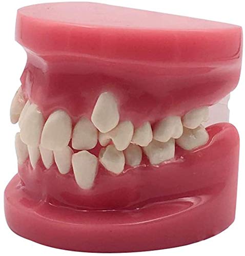 Modèle Orthodontique De Dents Adultes, Modèle Standard De Dents, Modèle Standard D'Étude Et D'Enseignement des Soins Dentaires pour l'enseignement en Laboratoir,Red