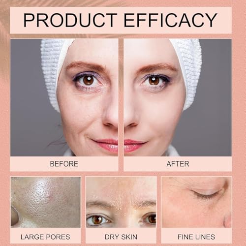 BATTLELAND Bio-Collagen Real Deep Mask, Pack of 4 - Image 3