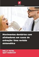 Movimentos dentários com alinhadores em casos de extração: Uma revisão sistemática (Portuguese Edition) 6206803163 Book Cover