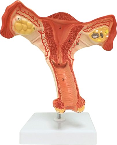 Image of Walter Products B10464 Plastic Female Internal Organ