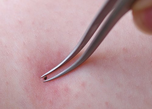 Faude Zeckenzange, Zeckenpinzette zum entfernen von Zecken jeder Größe ohne sie zu quetschen mit rund gebogen, fein spitz geschliffener Spitze, Edelstahl12,5cm