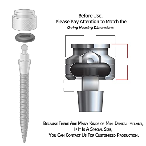 O-Ring, Buna-n, Tool Kit with 3 Convenient Sizes, Replacement for Mini Dental Implants