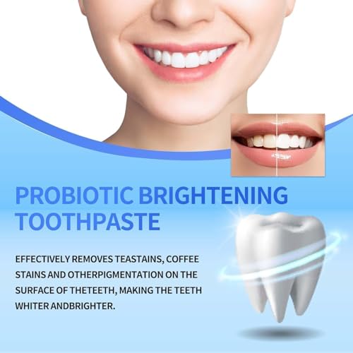 SP-8 Ultra Whitening Toothpaste,Toothpaste Sp-8 Brightening,sp-8 probiotic Toothpaste,Probiotics Bright White Toothpaste,Deep Cleaning Oral Care Toothpaste 120G - Image 6