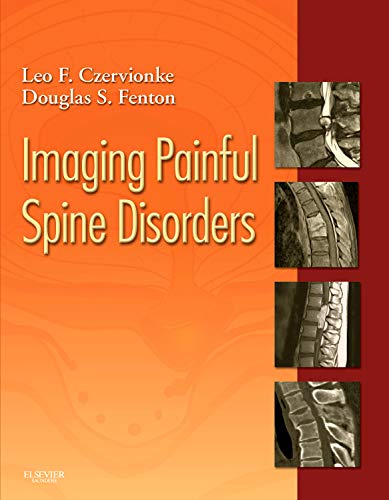 健康・医学 Imaging Painful Spine Disorders // 2011 Imaging persistent spinal pain syndrome and spine surgery 健康・医学