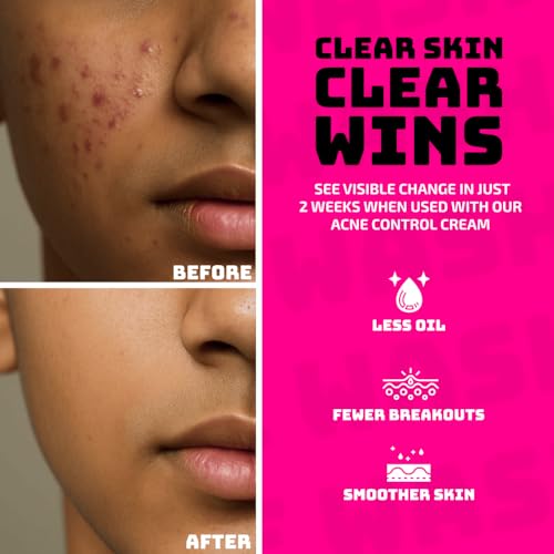 Image of Elemen Anti-Acne Face Wash for Boys (120ml) | Pimple Clear & Oil Control for Teens | Sebocytine Face Wash for Acne-Prone Skin | For Active Guys & Sports | Salicylic Acid free | Non stripping