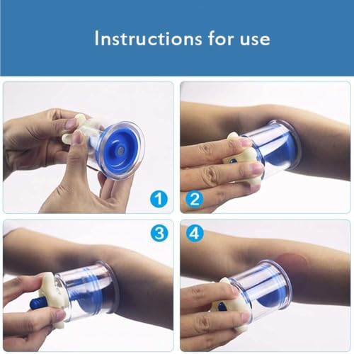 Juego de Ventosas de Vacío para Terapia de Cupping, Diseño Manual Giratorio para Masaje en Puntos de Acupuntura TCM en Todo el Cuerpo, Uso Profesional en Salones de Belleza miniatura 4