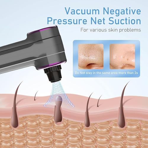 Image of Docoss Ultrasonic Black head Remover Tool with Heating Mode -Rechargeable White heads & Blackhead Removal Machine for Nose with 5 Suction Levels and Probes, 2 in 1 Pore Cleaner for Brighter Face