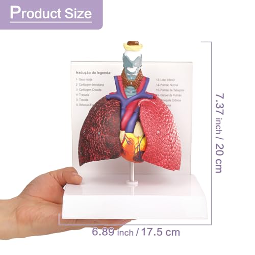 Image of HADWYN Human Respiratory System model,anatomy models human body