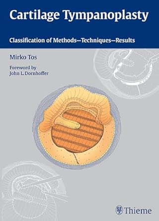 Cartilage Tympanoplasty: Classification of Methods - Techniques - Results Cartilage Tympanoplasty: Classification of Methods - Techniques - Results book cover