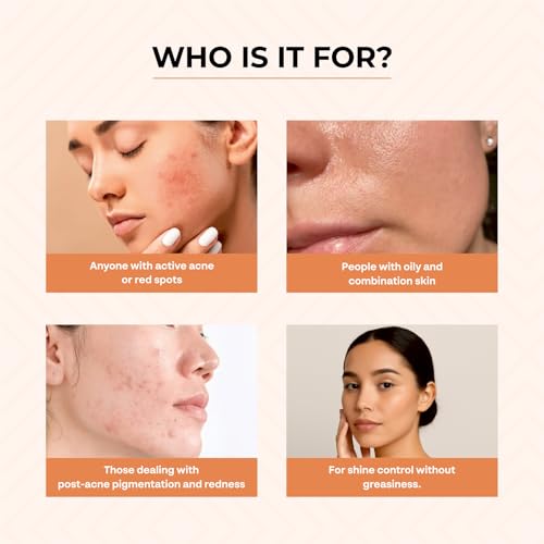Image of Dr. Sakhiya's Acne & Pimple Morning Cream (50gm) for Oily & Acne-Prone Skin | 5% Azelaic Acid 5% Niacinamide 2% Salicylic Acid | Reduces Dark Spots & Breakouts | Non-Greasy Day Moisturizer