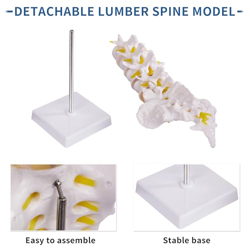 Image of Lumbar Spine Model for Anatomy Education, Life Size Human Lumbar Model with 5 Vertebrae Sacrum, Spinal Disc, and Sturdy Base, Ideal Tool for Medical Teaching and Learning