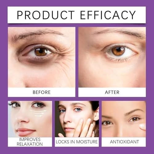 Pro-Essence Active Anti-Wrinkle Eye Cream for Dark Circles, Puffiness & Fine Lines, Deep Moisturizing & Firming UnderEye Treatment with Bifidobacterium Extract, Hexapeptide-8 & Centella Asiatica, Brightening Anti-Aging Eye Care Cream 15g 3