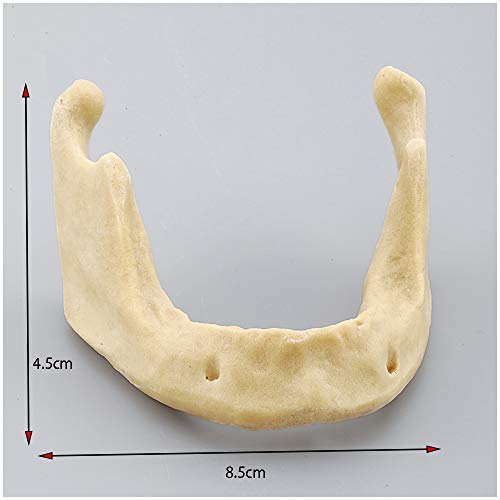 Modèle d'implant mandibulaire : formation au forage sans risque