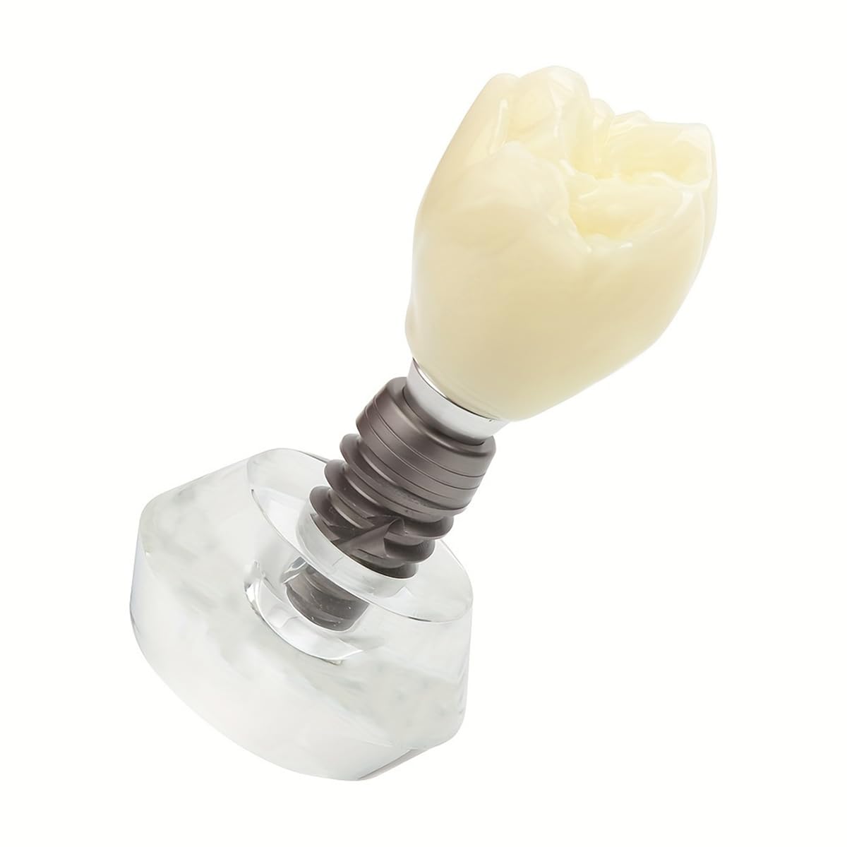 Dental Clear Implant Model Detail Implant Demonstration Detachable Crystal Crown Typodont Structure for Training and Education