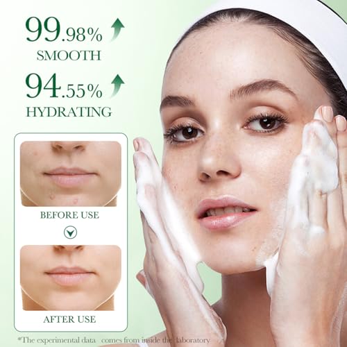Facial Cleanser With Centella Asiatica Extract, Gentle Facial Cleanser for Facial Cleansing Anti-Pimple Face Wash Gel - Image 3