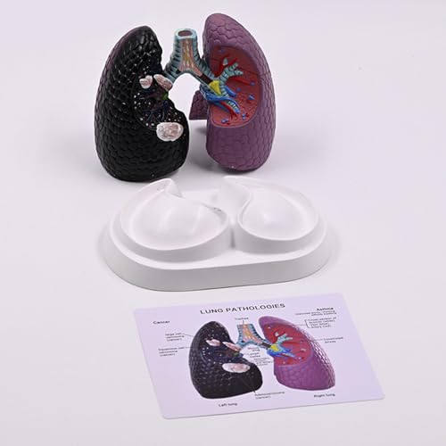 Modèle anatomique pathologique pulmonaire pour l'enseignement médical