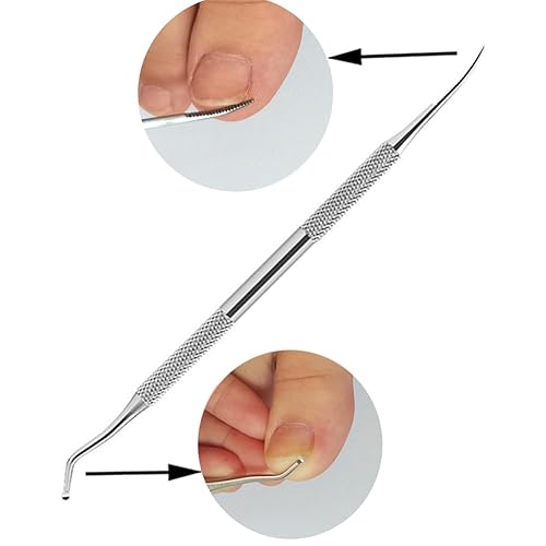 Miniatura 6 de Tratamiento de uñas encarnadas, kit de eliminación de uñas encarnadas, 50 calcomanías de corrección de uñas encarnadas, 50 parches correctores de