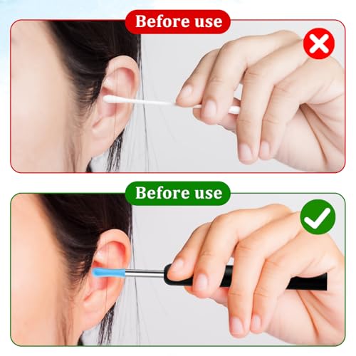 Ear Wax Removal Replacement Tips for Ear Camera 30Pcs Ear Spoon Tips for Wet/Dry Ear Ear Cleaner Tips Wax Cleaning Ear Spoons Tips Silicone Soft Cleaning Reuse Cap for Ear Wax Removal Endoscope - Image 4