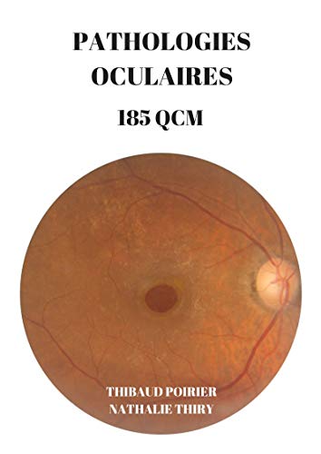 Télécharger PATHOLOGIES OCULAIRES 185 QCM Gratuit