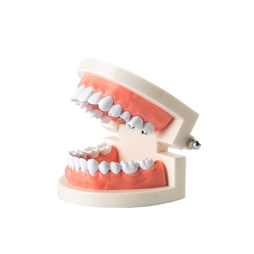 Modelo de estudio de caries dentales, modelo de dientes de caries para enfermedad, modelo estándar de demostración de tipodonto, para niños,