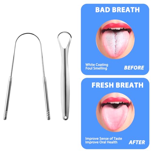 Ram® 2 x Tongue Scrapper Stainless Steel 1 U & 1 Y Shaped Tongue Cleaner Oral Tongue Cleaner - Image 4