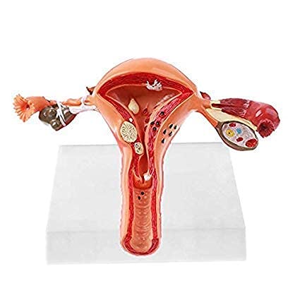 See full amazon price history chart for KKI Female Uterus with Ovary Pathological Anatomical Model | Diseased 3d Anatomy of Human Reproductive System perfect for Medical Students and Training KKI Female Uterus with Ovary Pathological Anatomical Model | Diseased 3d Anatomy of Human Reproductive System perfect for Medical Students and Training (B07XN869ML) Amazon Price History, Amazon Price Tracker