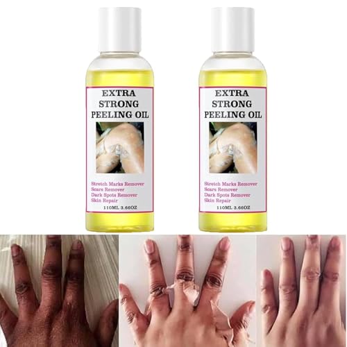 Yellow Peeling Oil for Dark Skin Extra Strong Peeling Oil Natural Formula Exfoliating Peels Solution for Face Body Hands and Foot Dead Skin Remover (220ML/7.76 OZ)