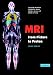 MRI from Picture to Proton