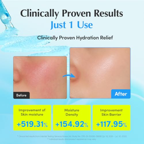 Image of EQQUALBERRY Hyaltoin Flooding Smoothie Serum | 5% Hyaluronic Acid Serum for Face & Redness Relief | Deep Hydrating Cooling Care with 5 Ceramides & Ectoin | Korean Skincare (1.01oz / 30ml)