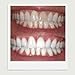 ExpertWhite Max+ 35% Carbamide Peroxide Teeth Whitening Gel Refill Syringes (4 Gels, 3cc Each). Tooth Whitening Gel for Bleaching Teeth with Trays Best Dentist Grade Gels White Teeth Fast.
