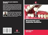 Biomateriais para implantes dentários (Portuguese Edition) 6208963052 Book Cover