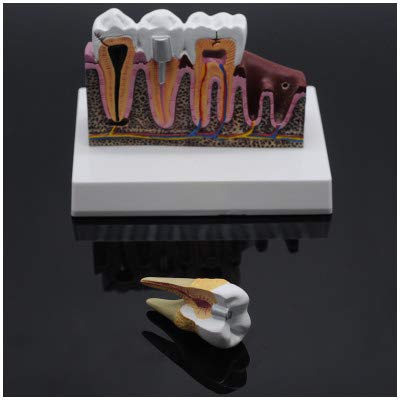 sjdoPulse Anatomy Teeth Model - Teeth Model for Educational - Simulation Oral Tooth Teeth Demonstration Model - Detachable Tooth Anatomical Model - for Study Teaching (A)