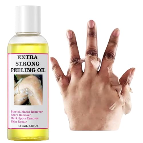 Yellow Peeling Oil for Dark Skin, Extra Strong Peeling Oil, Chemical Peel for Face & Body, Natural Formula Exfoliating Solution for All Skin Type Dead Skin Remover, 110ML/3.88 Fl Oz