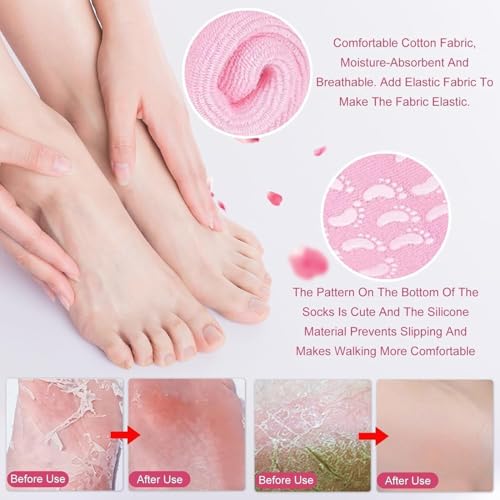Image of Silicone Gel Moisturizing Socks, Vitamin E Infused Heel Repair Spa Socks for Cracked Feet, Reusable Unisex Foot Care Treatment, 1 Pair, Multicolour