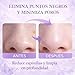 Imagen de Limpiador Facial Removedor de Puntos Negros