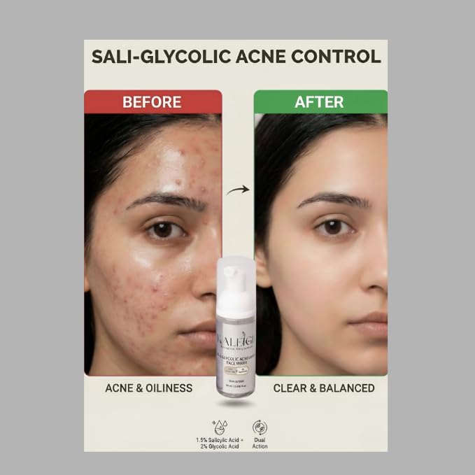 Image of KALEIGH Sali-Glycolic Acnecontrol Foaming Face Wash for Oily & Acne-Prone Skin Type | Tan Removal Cleanser for Men & Women | Deep Cleans Pores, Controls Excess Oil | Glowing, Moisturizing & Brightening Skin | Gently Exfoliates (120ml, Pack of 2)