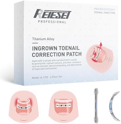 Titanium Alloy Ingrown Toenail Treatment, NailTools, and Ingrown Toenail Removal Kit SpeciallyDesigned for Curved Nail Repair and Ingrown ToenailCorrector (0.59/0.67in)