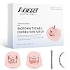 Titanium Alloy Ingrown Toenail Treatment, Nail Tools, and Ingrown Toenail Removal Kit Specially Designed for Curved Nail Repair and Ingrown Toenail Corrector (0.59/0.67in)